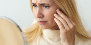 Até 15% dos pacientes de cirurgia plástica podem apresentar Transtorno Dismórfico Corporal (TDC)