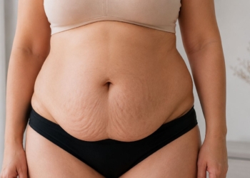 Abdômen em avental: quando o excesso de pele vai além da estética e afeta saúde física e emocional